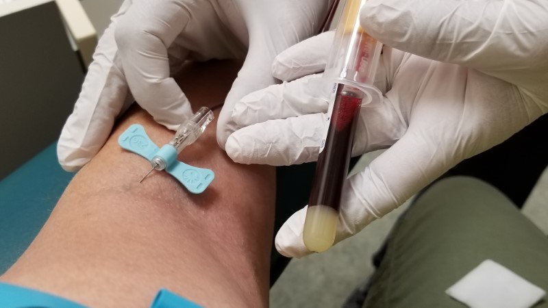 nakuwanie pacjenta w celu pobrania krwi